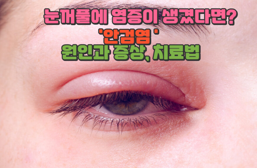 눈꺼풀에 염증이 생겼다면? 안검염 원인과 증상, 치료법 정리